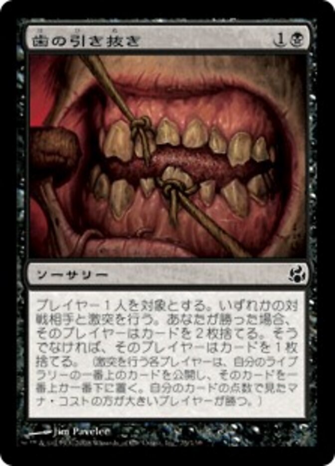 歯の引き抜き